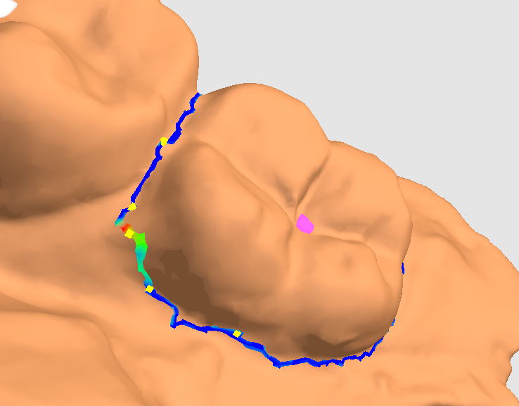 Tooth nodes being used